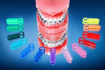 Stock Image of Different Teeth Clips
