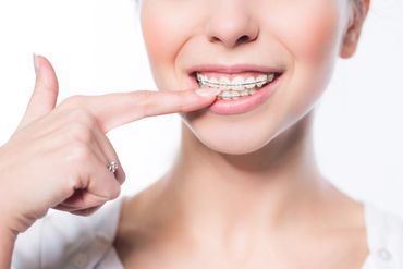 Stock Image of Model showing her Teeth Clip