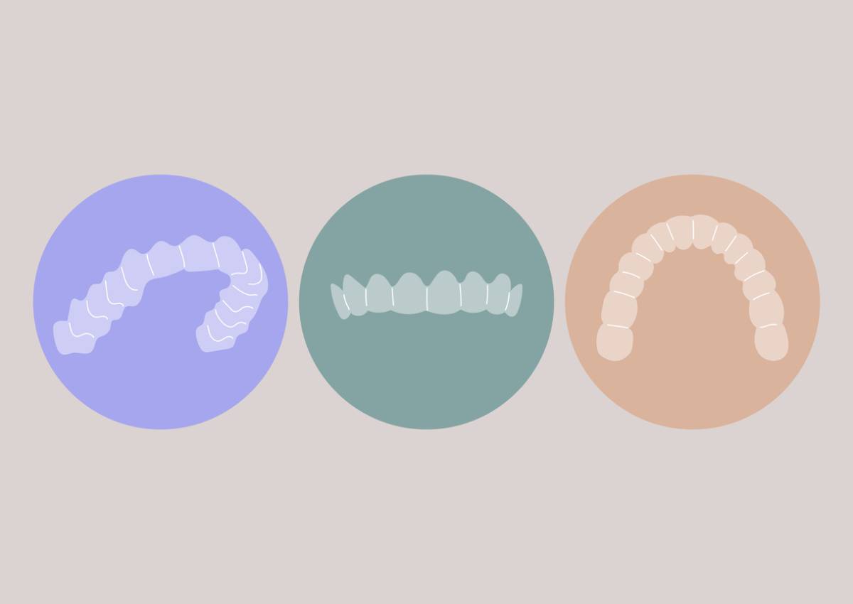 graphic of several invisalign braces